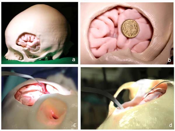 3D printing AIDS in medical surgery 3